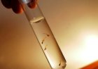 Índice de Breteau indica queda no número de mosquitos da dengue em fase de desenvolvimento em Bariri