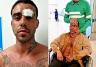 Homofobia: fotógrafo tem duas costelas quebradas ao ser agredido por mais de 10 pessoas avenida de em Bauru