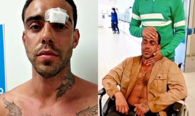 Homofobia: fotógrafo tem duas costelas quebradas ao ser agredido por mais de 10 pessoas avenida de em Bauru