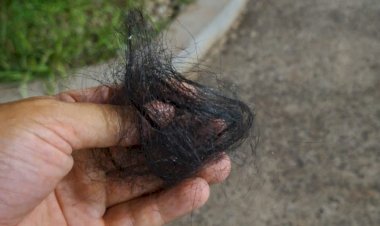 Mulher tem cabelo arrancado pelo marido, que acaba preso por violência doméstica em Itapuí