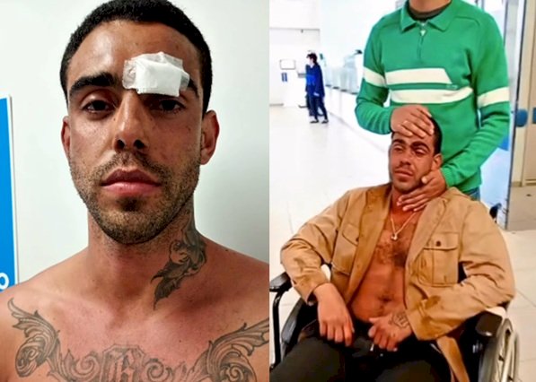 Homofobia: fotógrafo tem duas costelas quebradas ao ser agredido por mais de 10 pessoas avenida de em Bauru